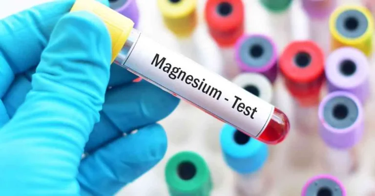 How to Lower Magnesium in Reef Tank?